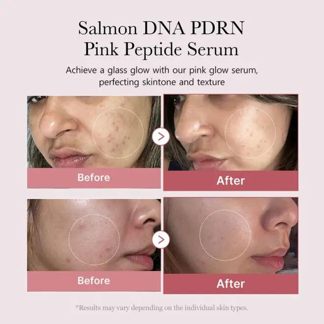 Vesellia PDRN Pink Peptide Serum