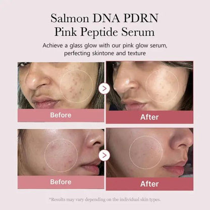 Vesellia PDRN Pink Peptide Serum